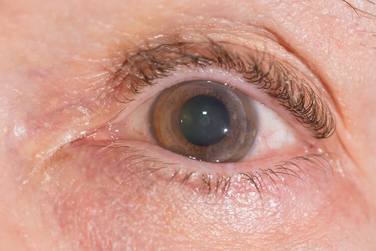 Closeup of an Eye