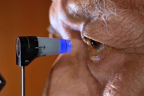 Man Having an Eye Exam